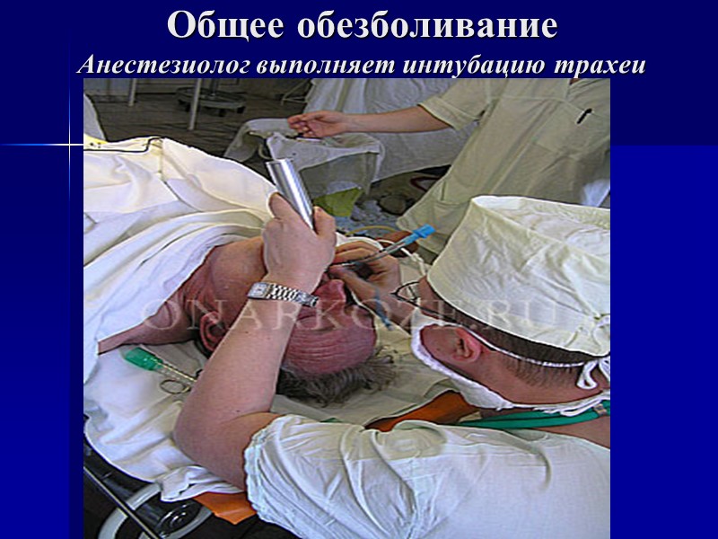 Общее обезболивание Анестезиолог выполняет интубацию трахеи